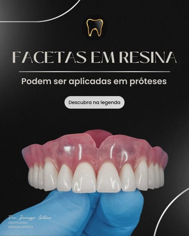 Clínica GT odontologia em São Mateus do Sul especialistas em Implante dentário
