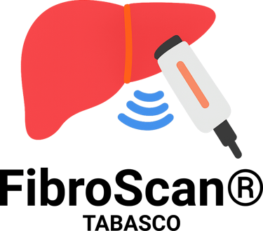 Fibroscan® Tabasco logo