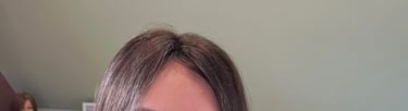 After permanent non-surgical hair replacement #15 with strand by strand method – subtle, natural enh