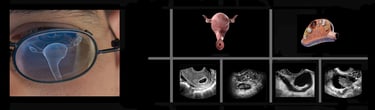 Panel of images showing transvaginal ultrasound findings.