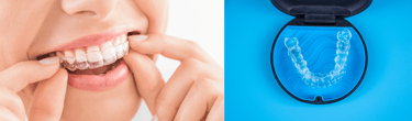 Best Invisalign Provider