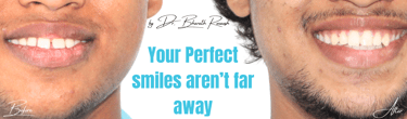 orthodontic treatment near Chromepet