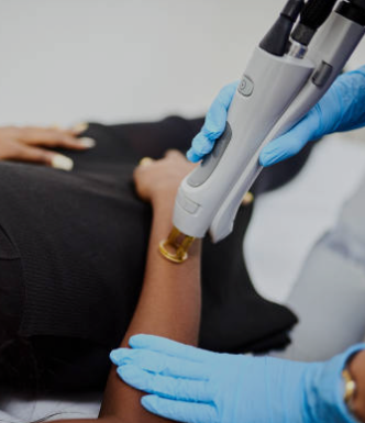 laser arm treatment