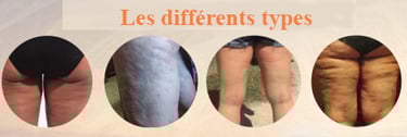 differents types