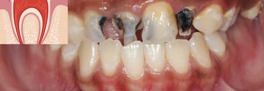 dental cares