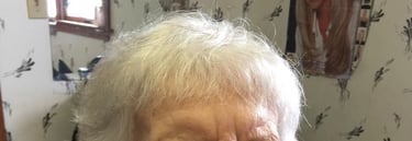 After permanent non-surgical hair replacement #3 with integration method – integrated system adding 