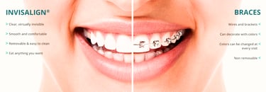 Invisalign near me