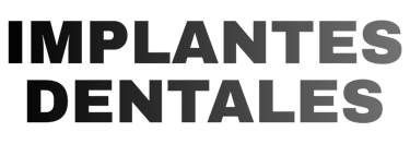 implantes dentales en las palmas de gran canaria