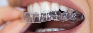 Girne, Kıbrıs’ta uzman diş hekimi Dr. Dt. Kemal Güldüren | Diş teli, ortodonti, şeffaf plak.