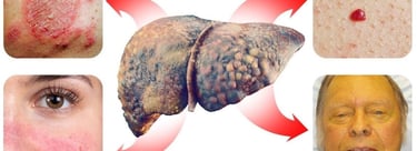 العلامات على الوجه والجلد