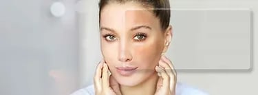 Pigmentation ray and rio's speciality clinic