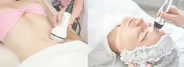 RF Tightening  ray and rio's speciality clinic