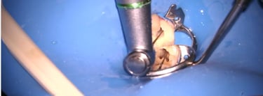 A high-speed dental drill performing a root canal procedure on a tooth isolated by a blue rubber dam.