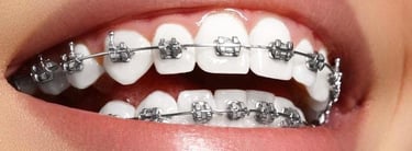 Girne, Kıbrıs’ta uzman diş hekimi Dr. Dt. Kemal Güldüren | Diş teli, ortodonti, şeffaf plak.