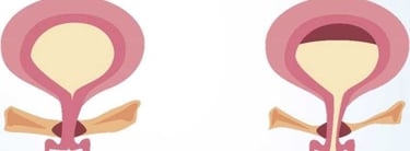 фото Схема мускулатури тазового дна