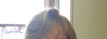 After permanent non-surgical hair replacement #2 with strand by strand method – restored volume at t