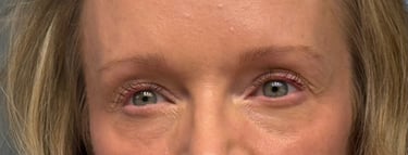 Light, untinted eyebrows before applying at home eyebrow tint.