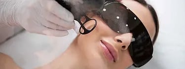 Acne Scars ray and rio's speciality clinic