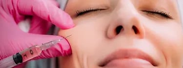 Skin Boosters ray and rio's speciality clinic