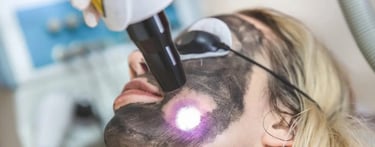 Carbon Laser Peel  ray and rio's speciality clinic