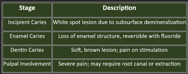Caries-stages