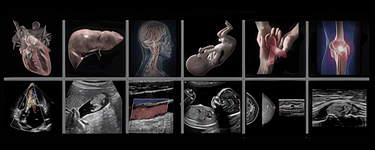 A panel of images Abdominal, Vascular, Obstetric, Breast, and MSK ultrasound training course images.