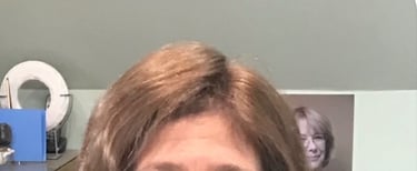 After permanent non-surgical hair replacement #12 with strand by strand method – denser top area wit