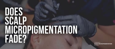 Professional scalp micropigmentation procedure in Toronto for hair loss restoration and density.