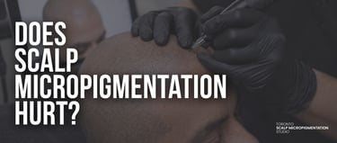Professional scalp micropigmentation artist performing a hair tattoo procedure on a bald head.