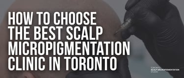 Professional performing scalp micropigmentation hair tattoo at a clinic in Toronto.