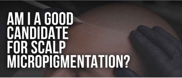 A scalp micropigmentation specialist marking a hairline for a hair loss treatment procedure.
