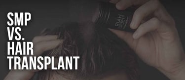 Comparing SMP vs hair transplant treatments using hair building fibers for thinning hair coverage.