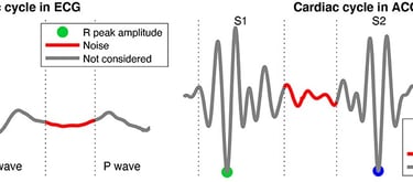 Representation of the signal of interest and noise segments of the cardiac cycle in the ECG and ACC