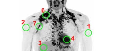 ❄️Precise Evaluation of Brown Adipose Tissue