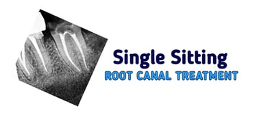 Single Sitting RCT Root Canal Treatment in Greater Noida