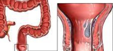 the small intestine beyond the duodenum, the colon, rectum, and anal canal.