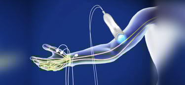 Dr.Rajinikanth's ortho clinic Nerve conduction study