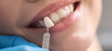 Best Veneers Laminates Treatments Clinic in Pune 