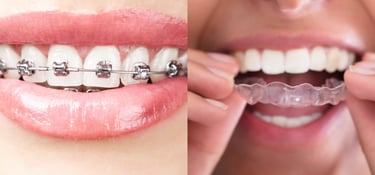 "DentalRestoration DentureCare GumSurgery OralAppliance OralHealthCare"
