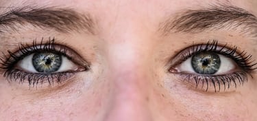 emdr- traumatisme- phobie