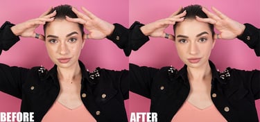 Blemishes Removal 