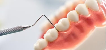 gingivite, parodontite timisoara