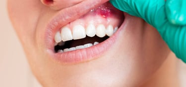 patologie orala Timisoara