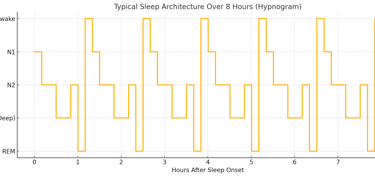 A graph of a Typical Sleep Architecture over 8 Hours (Hypnogram)