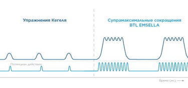 фото схема яка зрівнює вправи кегеля та пристрій BTL EMAELLA
