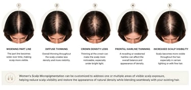 Diagram showing five stages of female hair loss patterns and thinning hair for scalp micropigmentation.