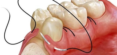 chirurgie orala si maxilofaciala Timisoara