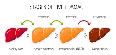 stages of fatty liver