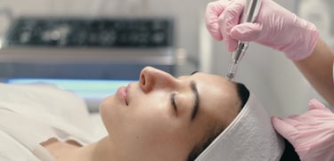 a woman is getting her face microneedled