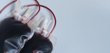 hemodiálisis sangre toxinas